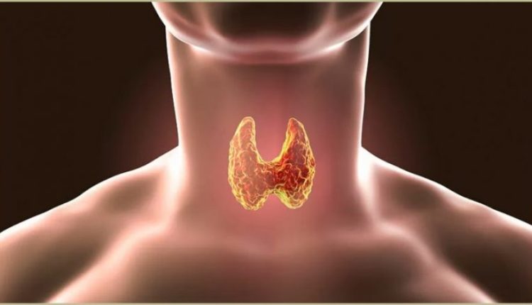Ushqimet që duhen shmangur sepse përkeqësojnë tiroiden
